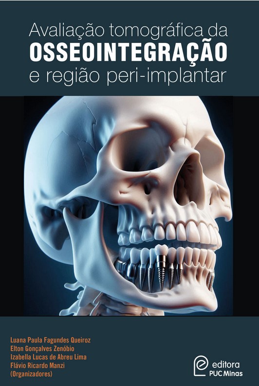 Avaliação tomográfica da osseointegração e região peri-implantar